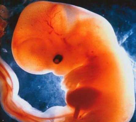 9周大的胎儿图片（9周大的胎儿图片大全）  第2张
