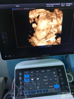 孕妇二维彩超检查什么啊?不知道一般情况下检查哪些方面,孕期彩超做的频繁对胎儿有影响吗 第2张 孕妇二维彩超检查什么啊?不知道一般情况下检查哪些方面,孕期彩超做的频繁对胎儿有影响吗 第2张