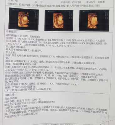 胎儿偏小有什么影响吗(胎儿偏小有什么影响吗女性) 第2张 胎儿偏小有什么影响吗(胎儿偏小有什么影响吗女性) 第2张