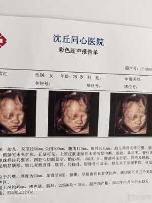 产检胎儿头偏大怎么办(孩子6个月大,看东西时总是歪着头) 第2张 产检胎儿头偏大怎么办(孩子6个月大,看东西时总是歪着头) 第2张