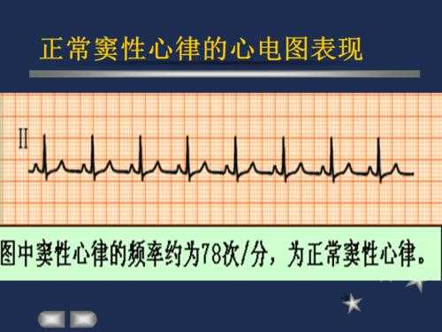 胎儿窦性心律什么意思(胎儿窦性心律什么意思1:1是什么意思) 第3张 胎儿窦性心律什么意思(胎儿窦性心律什么意思1:1是什么意思) 第3张