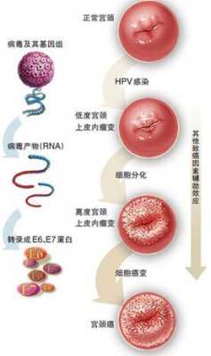 HPV感染了还能怀孕吗,hpv病毒会影响胎儿吗 第2张 HPV感染了还能怀孕吗,hpv病毒会影响胎儿吗 第2张
