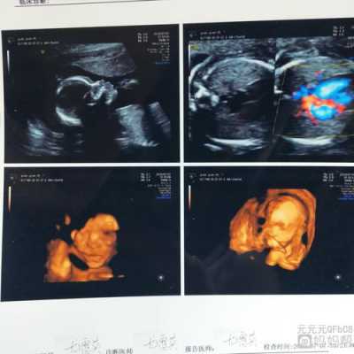 胎儿上唇连续是什么意思(胎儿上唇连续是什么意思) 第1张 胎儿上唇连续是什么意思(胎儿上唇连续是什么意思) 第1张