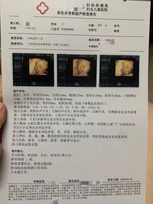 怀孕第8周有一点点褐色的分泌物,要紧吗,怀孕8周胎儿稳定了吗 有胎心了吗 第2张 怀孕第8周有一点点褐色的分泌物,要紧吗,怀孕8周胎儿稳定了吗 有胎心了吗 第2张