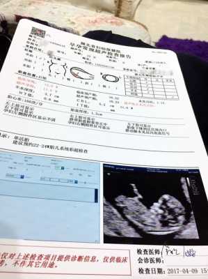 孕期nt(nt建档什么意思) 第3张 孕期nt(nt建档什么意思) 第3张
