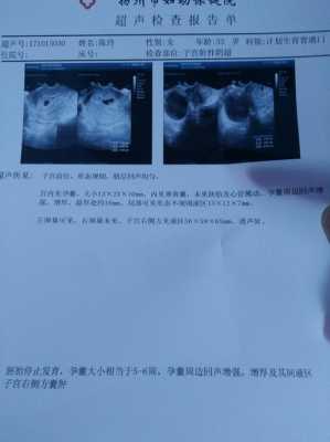 胎儿停止发育还有救吗(胎儿停止发育还有救吗) 第2张 胎儿停止发育还有救吗(胎儿停止发育还有救吗) 第2张