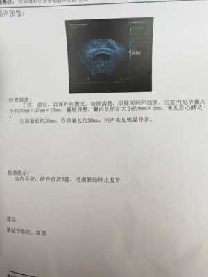 胎儿停止发育还有救吗(胎儿停止发育还有救吗) 第1张 胎儿停止发育还有救吗(胎儿停止发育还有救吗) 第1张