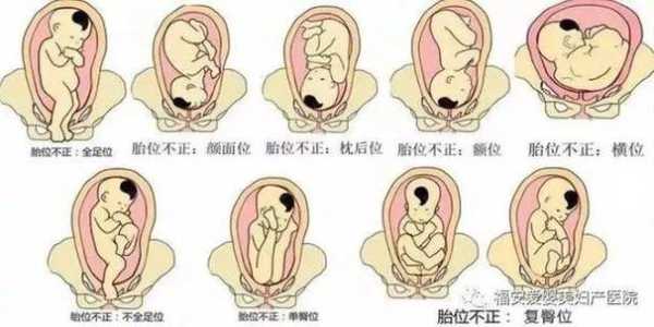 胎儿左枕前位是什么意思(胎儿左枕前位是什么意思图片) 第1张 胎儿左枕前位是什么意思(胎儿左枕前位是什么意思图片) 第1张