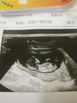 怀孕12周肚子有多大？12周的胎儿有胎动了吗,孕期12周检查什么项目  第1张