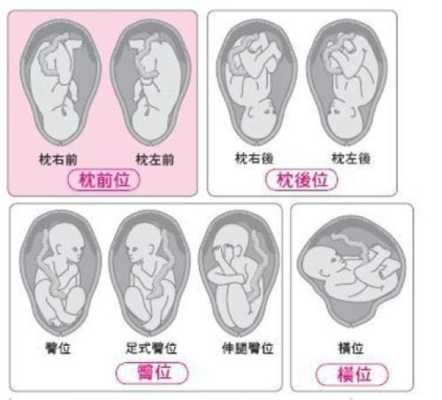 胎儿右枕前位是什么意思(胎儿右枕前位图片示意图) 第1张 胎儿右枕前位是什么意思(胎儿右枕前位图片示意图) 第1张