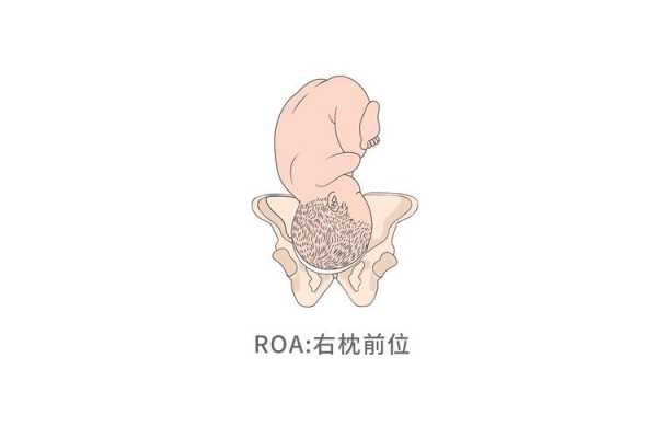 胎儿右枕前位是什么意思(胎儿右枕前位图片示意图) 第3张 胎儿右枕前位是什么意思(胎儿右枕前位图片示意图) 第3张