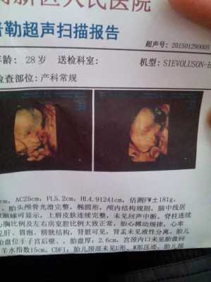 七周的宝宝为什么老闹脾气,怀孕七周胎儿图片欣赏 彩超 第3张 七周的宝宝为什么老闹脾气,怀孕七周胎儿图片欣赏 彩超 第3张
