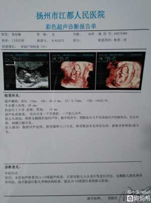 怀孕11周胎儿图片欣赏（怀孕11周胎儿稳定了吗?多少周才能稳定）  第2张