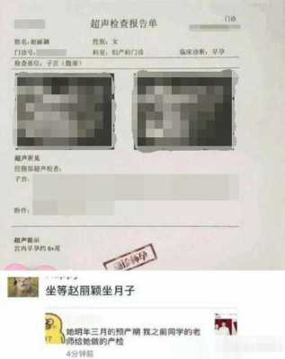 胎儿宫内发育迟缓的原因(为什么b超单怀孕周数比实际小一周多呢) 第2张 胎儿宫内发育迟缓的原因(为什么b超单怀孕周数比实际小一周多呢) 第2张