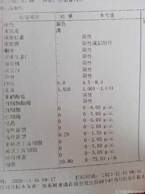 孕期尿常规(孕妇尿检病理管型高的会有什么影响的吗?还是有些害怕的) 第1张 孕期尿常规(孕妇尿检病理管型高的会有什么影响的吗?还是有些害怕的) 第1张
