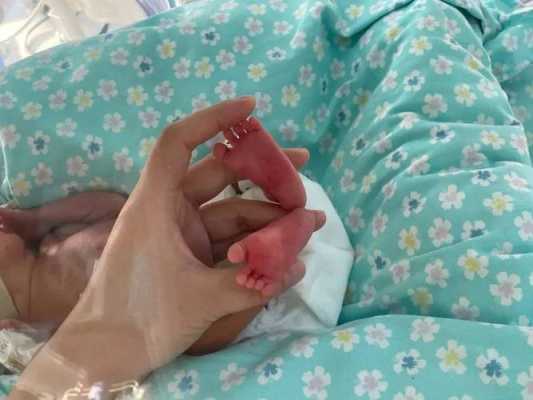 2个月婴儿37度2怎么办?宝宝37.2度是低烧吗,怀孕2个月的胎儿有多大图片 第2张 2个月婴儿37度2怎么办?宝宝37.2度是低烧吗,怀孕2个月的胎儿有多大图片 第2张