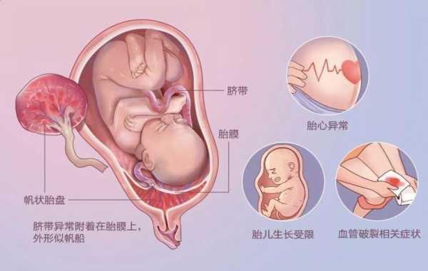 胎盘脱落对胎儿有什么影响（胎盘脱落是怎么引起的）  第3张
