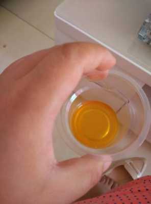 孕妇尿红对胎儿影响吗（孕妇尿红对胎儿影响吗孕晚期）  第1张