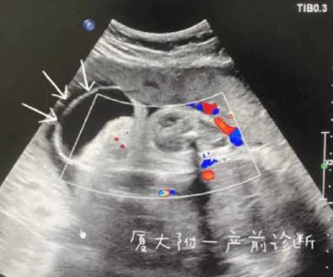孕妇发脾气对胎儿有什么影响（怀孕四个月经常生气哭对胎儿有什么影响）  第1张