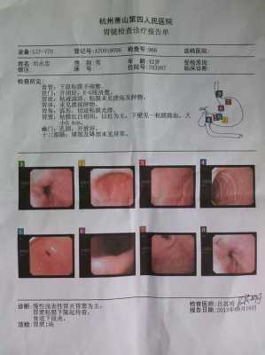 孕期一月之内吃治疗胃炎的药怎样做检查排除胎儿畸形,孕期胃炎犯了怎么办 第2张 孕期一月之内吃治疗胃炎的药怎样做检查排除胎儿畸形,孕期胃炎犯了怎么办 第2张