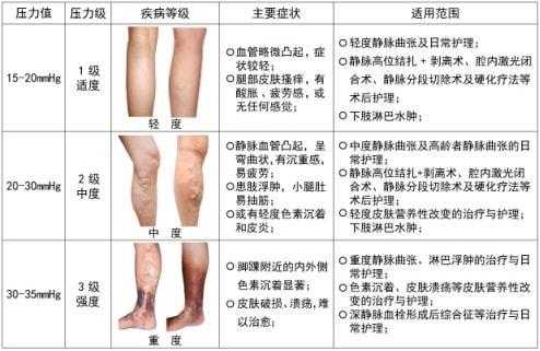 孕妇静脉曲张危险吗,孕期腿肿是什么原因引起的 第1张 孕妇静脉曲张危险吗,孕期腿肿是什么原因引起的 第1张