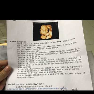孕24周四维彩超检查主要是看什么,胎儿24周四维彩超图片 第1张 孕24周四维彩超检查主要是看什么,胎儿24周四维彩超图片 第1张
