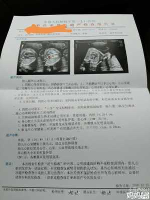 胎儿心脏彩超内有强回声点严重吗,胎儿心脏不好早期10个征兆 第1张 胎儿心脏彩超内有强回声点严重吗,胎儿心脏不好早期10个征兆 第1张