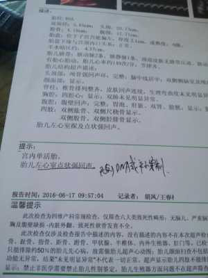 胎儿心脏彩超内有强回声点严重吗,胎儿心脏不好早期10个征兆 第2张 胎儿心脏彩超内有强回声点严重吗,胎儿心脏不好早期10个征兆 第2张