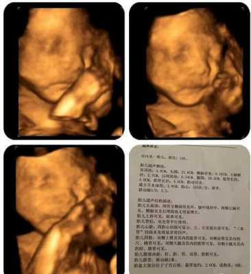 胎儿嘴唇什么时候形成(胎儿嘴唇什么时候开始发育) 第1张 胎儿嘴唇什么时候形成(胎儿嘴唇什么时候开始发育) 第1张