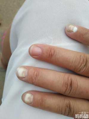 孕期变白(孕期变白了生出来的小孩会很白吗) 第2张 孕期变白(孕期变白了生出来的小孩会很白吗) 第2张