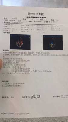 胎儿右心房增大的原因(左心房增大,怎么回事) 第2张 胎儿右心房增大的原因(左心房增大,怎么回事) 第2张