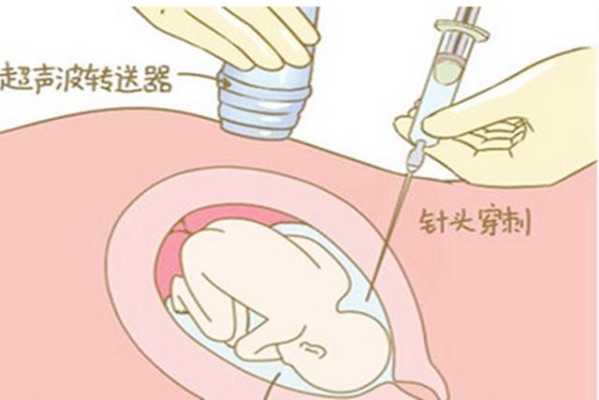 做羊水穿刺对胎儿有影响吗(孕妇抽羊水检查对胎儿有危害吗) 第2张 做羊水穿刺对胎儿有影响吗(孕妇抽羊水检查对胎儿有危害吗) 第2张