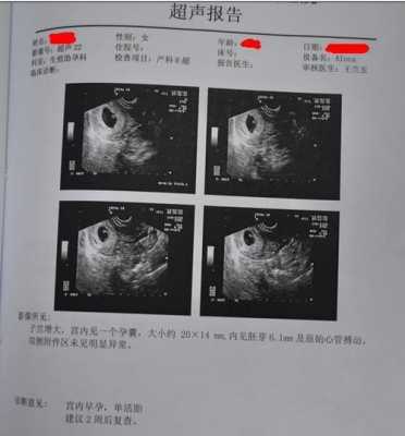 怀孕10周胎儿成型了吗(怀孕10周孕囊胎芽大小是多少,可以介绍下的吗) 第1张 怀孕10周胎儿成型了吗(怀孕10周孕囊胎芽大小是多少,可以介绍下的吗) 第1张