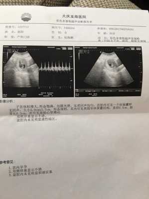 怀孕10周胎儿成型了吗(怀孕10周孕囊胎芽大小是多少,可以介绍下的吗) 第2张 怀孕10周胎儿成型了吗(怀孕10周孕囊胎芽大小是多少,可以介绍下的吗) 第2张