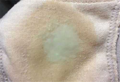 怀孕后分泌物是黄色,孕期分泌物黄色正常吗 第2张 怀孕后分泌物是黄色,孕期分泌物黄色正常吗 第2张