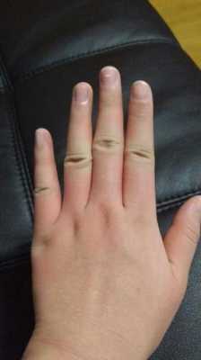 孕期手肿(孕期手肿胀握拳有紧绷感觉) 第2张 孕期手肿(孕期手肿胀握拳有紧绷感觉) 第2张
