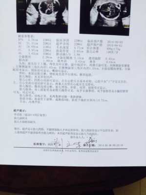 胎儿小脑欠饱满严重吗(胎儿小脑欠饱满严重吗怎么治疗) 第3张 胎儿小脑欠饱满严重吗(胎儿小脑欠饱满严重吗怎么治疗) 第3张