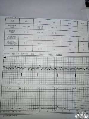 孕妇紧张会影响胎儿心率吗(胎心170-180有危险吗) 第2张 孕妇紧张会影响胎儿心率吗(胎心170-180有危险吗) 第2张
