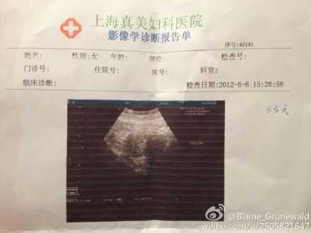孕期周期（b超单显示的怀孕周数准确吗）  第2张