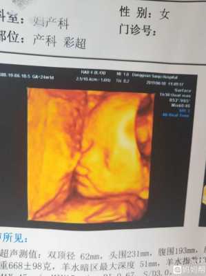 胎儿兔唇四维彩超图片(兔唇彩超能看出来吗) 第2张 胎儿兔唇四维彩超图片(兔唇彩超能看出来吗) 第2张