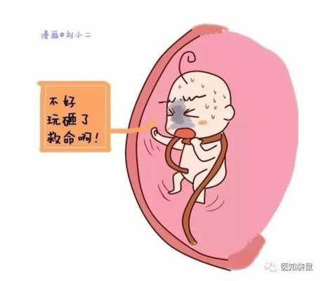 孕28周B超时检查说宝宝脐带绕颈一周对胎儿有影响吗,脐带打结对胎儿的影响大吗 第2张 孕28周B超时检查说宝宝脐带绕颈一周对胎儿有影响吗,脐带打结对胎儿的影响大吗 第2张