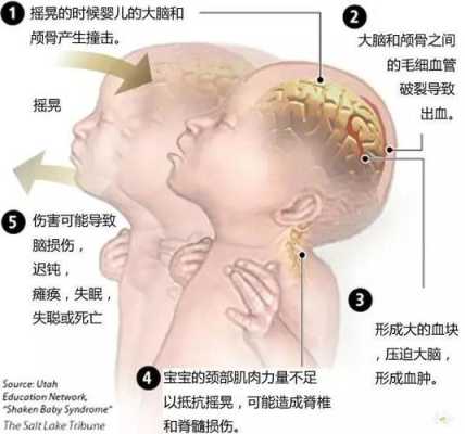孕妇撞击致胎儿脑损伤(孕妇撞击致胎儿脑损伤) 第2张 孕妇撞击致胎儿脑损伤(孕妇撞击致胎儿脑损伤) 第2张