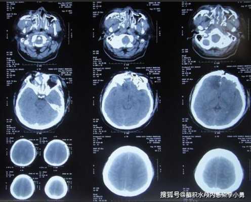 孕妇撞击致胎儿脑损伤(孕妇撞击致胎儿脑损伤) 第1张 孕妇撞击致胎儿脑损伤(孕妇撞击致胎儿脑损伤) 第1张