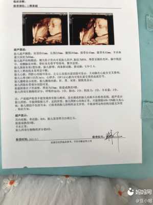 在三维彩超时宝宝缩成一团怎么办,胎儿蜷缩成一团彩超图,孕17周 第2张 在三维彩超时宝宝缩成一团怎么办,胎儿蜷缩成一团彩超图,孕17周 第2张