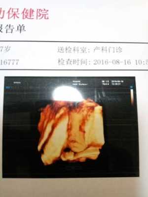 四维显示胎儿左心室强光点要紧吗(四维显示胎儿左心室强光点要紧吗唐氏筛查临界风险) 第2张 四维显示胎儿左心室强光点要紧吗(四维显示胎儿左心室强光点要紧吗唐氏筛查临界风险) 第2张
