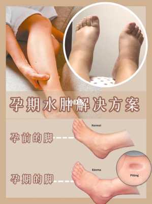 缓解孕期水肿(孕妇脚浮肿怎么缓解?怀孕九个多月,水肿很厉害有什么办法能改善) 第1张 缓解孕期水肿(孕妇脚浮肿怎么缓解?怀孕九个多月,水肿很厉害有什么办法能改善) 第1张