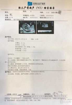 孕期nt检查(孕期nt检查什么项目) 第3张 孕期nt检查(孕期nt检查什么项目) 第3张