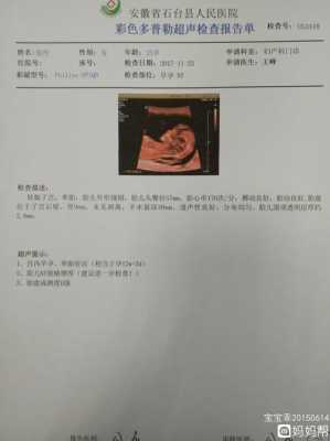 孕期nt检查(孕期nt检查什么项目) 第2张 孕期nt检查(孕期nt检查什么项目) 第2张