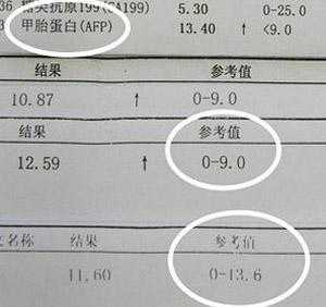 孕期甲胎蛋白(孕期甲胎蛋白高怎么回事) 第3张 孕期甲胎蛋白(孕期甲胎蛋白高怎么回事) 第3张