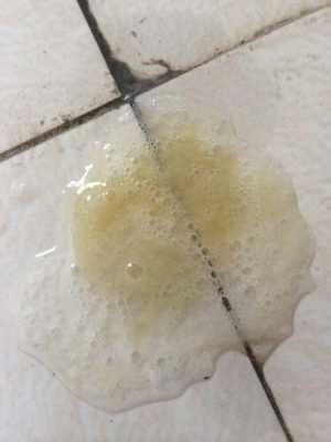 孕期痰多(孕期痰多是什么原因造成的) 第3张 孕期痰多(孕期痰多是什么原因造成的) 第3张